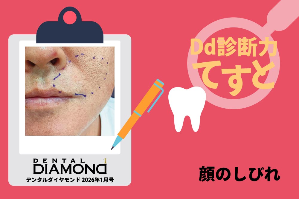 Dd診断力てすと『顔のしびれ』デンタルダイヤモンド 2026年1月号