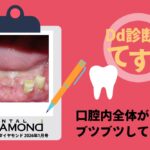 Dd診断力てすと『口腔内全体がブツブツしている』デンタルダイヤモンド 2026年1月号