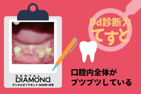 Dd診断力てすと『口腔内全体がブツブツしている』デンタルダイヤモンド 2026年1月号