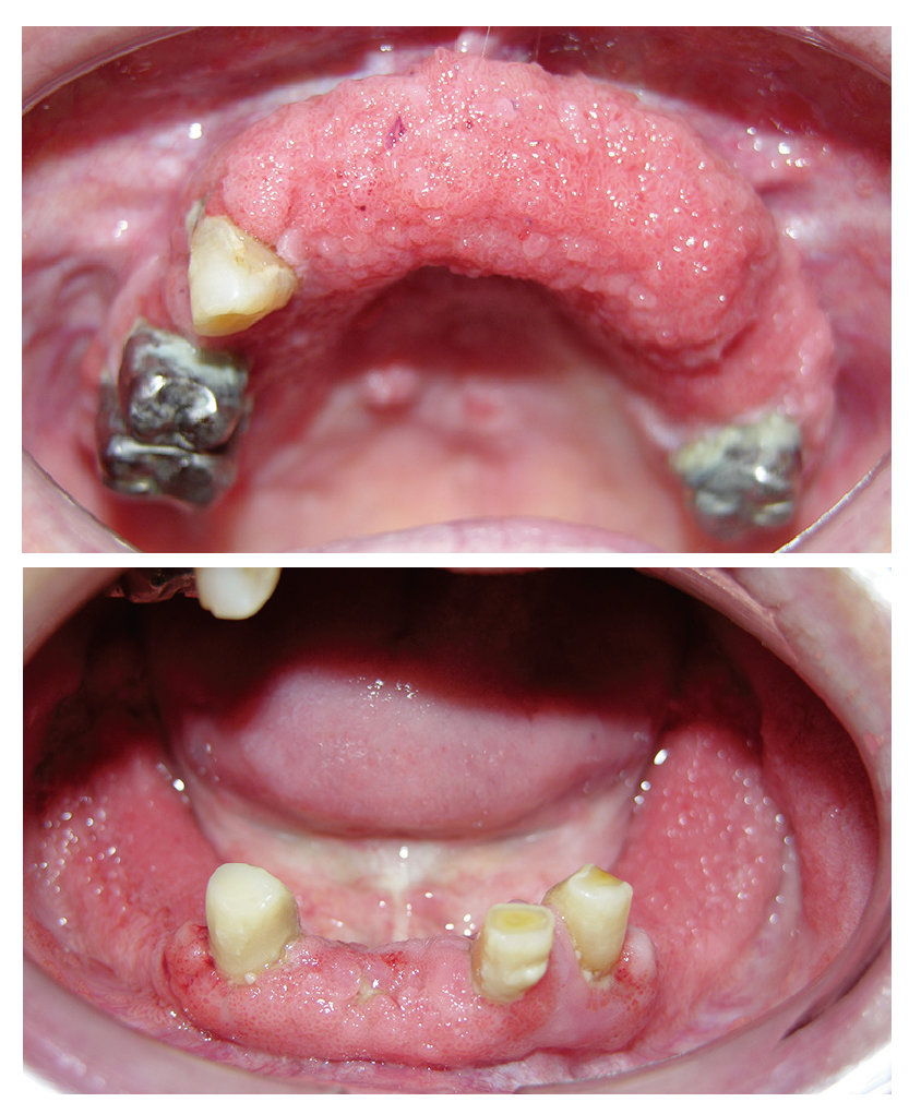 図❶　初診時の口腔内写真
