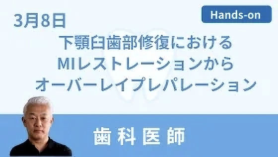 東京】下顎臼歯部修復におけるMIレストレーションからオーバーレイ