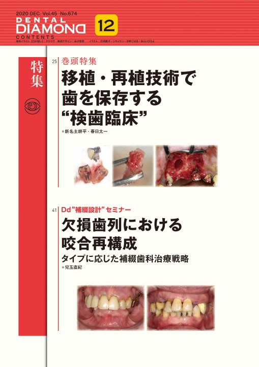 デンタルダイヤモンド 2020年12月号