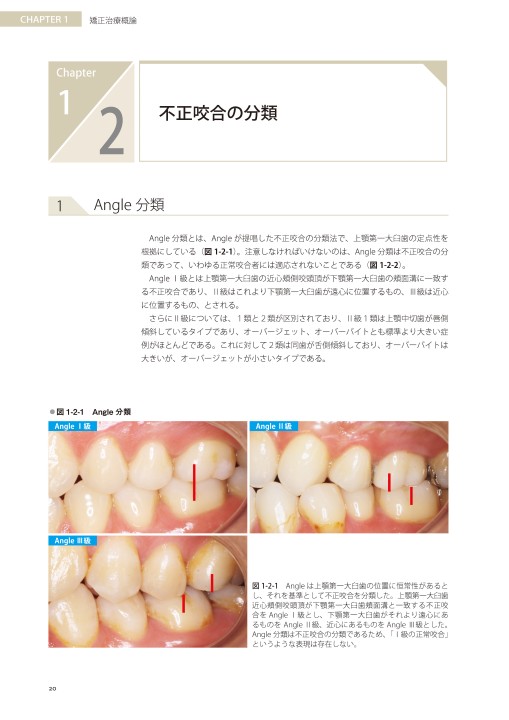 藤本研修会 Standard Textbook 3 Limited Orthodontic Treatment（LOT）