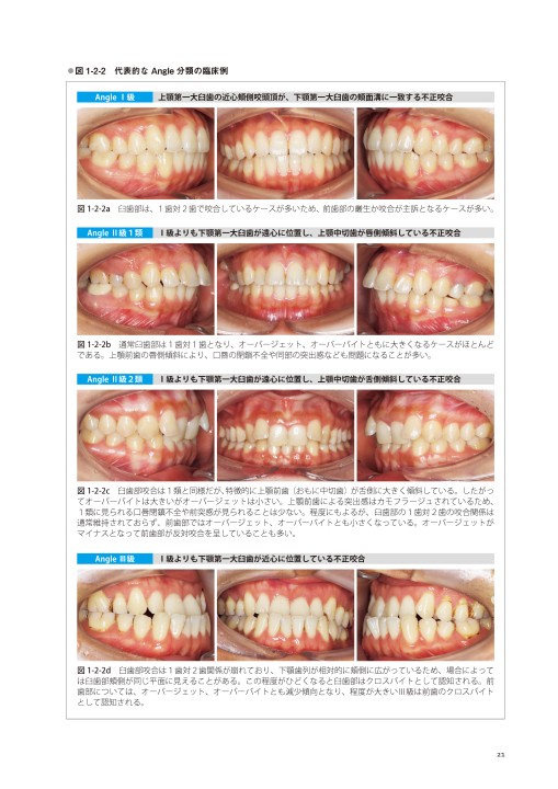藤本研修会 Standard Textbook 3 Limited Orthodontic Treatment（LOT）