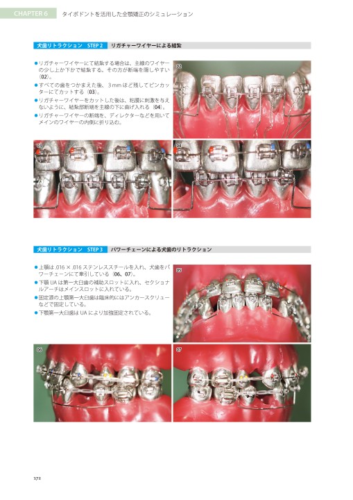 【裁断済み】藤本研修会Ｓｔａｎｄａｒｄ　Ｔｅｘｔｂｏｏｋ　１〜３ 藤本研修会 Standard Textbook 3 Limited Orthodontic Treatment（LOT）