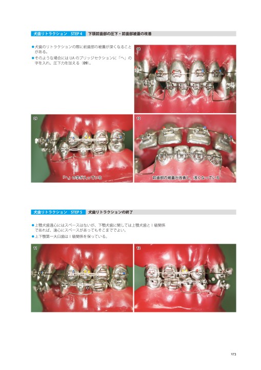 【裁断済み】藤本研修会Ｓｔａｎｄａｒｄ　Ｔｅｘｔｂｏｏｋ　１〜３ 藤本研修会 Standard Textbook 3 Limited Orthodontic Treatment（LOT）