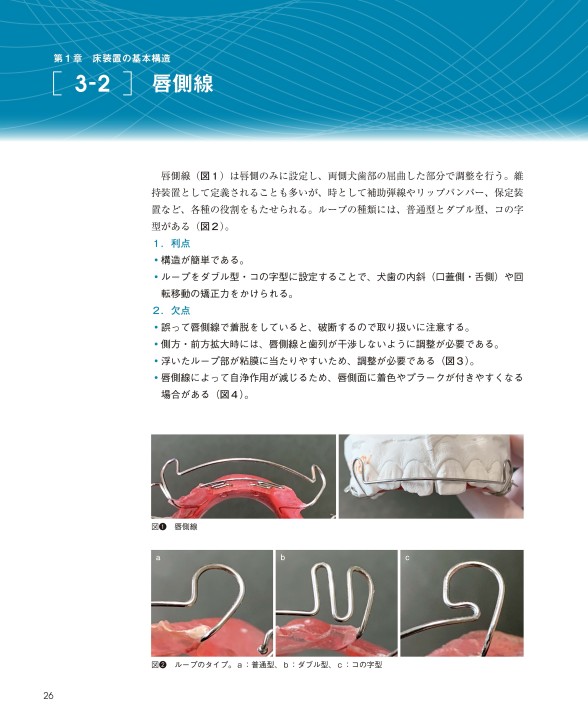 GPのための床矯正治療を成功させる床装置と設計
