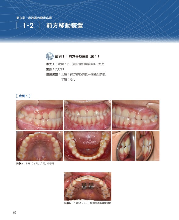 GPのための床矯正・矯正のすすめ 活用編| 歯科総合出版社